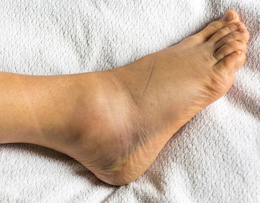 Your ankles disappear into 